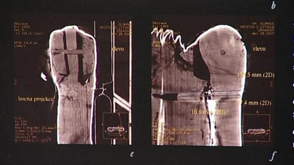 Auf Bildern eines Computertomographen waren allerdings bewegliche Schultergelenke unter den Stoffbandagen zu sehen  (Foto: ČT 24)