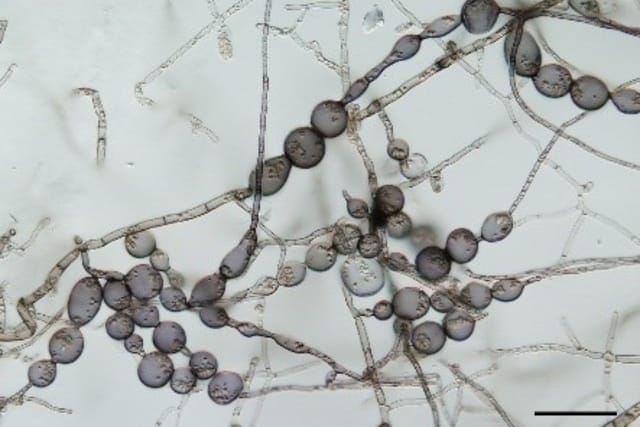 Thalassodendromyces purpureus | Foto: Martin Vohník,  Tschechische Akademie der Wissenschaften